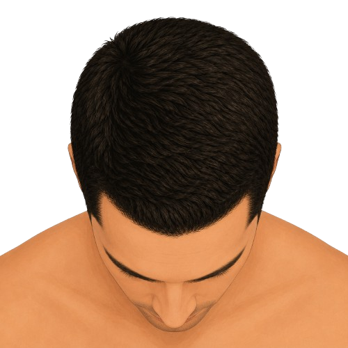 Stage 1 – top view