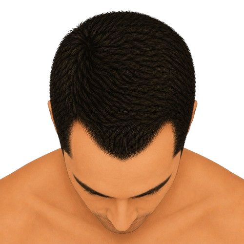 Stage 2 – top view