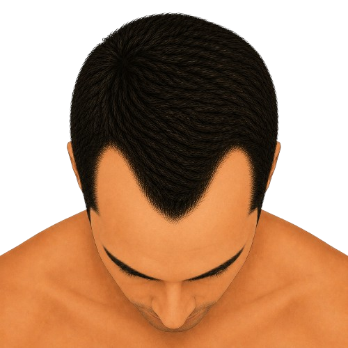 Stage 3 – top view