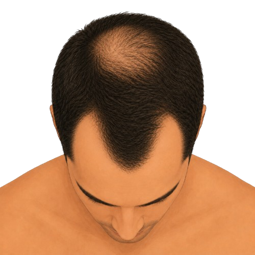 Stage 4 – top view