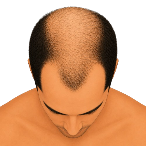 Stage 5 – top view